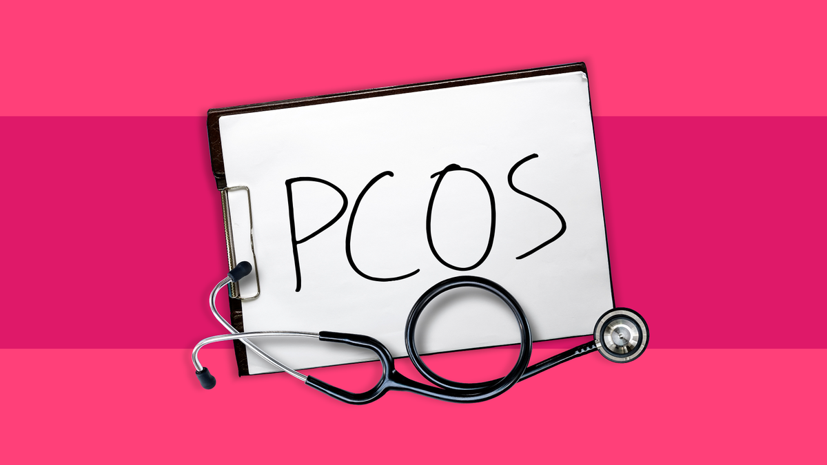 Kas yra PCOS?